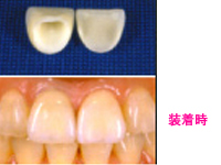 �����륻��ߥå���