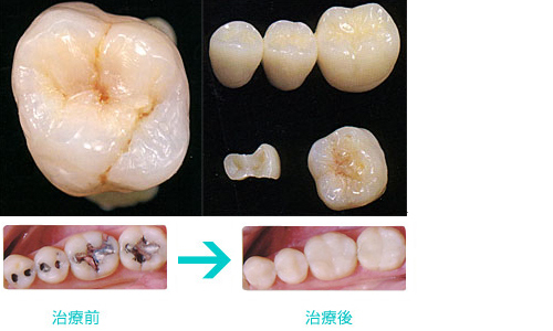 �ϥ��֥�åɥ���ߥå�����