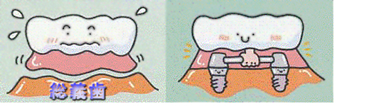 �����ϥ��å�