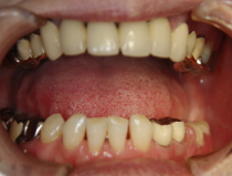 �����̥��������ͥ����פ���ʬ�����