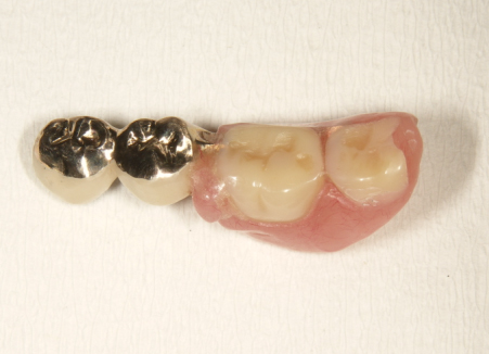 �����̥��������ͥ����פ���ʬ�����