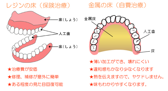 �쥸�󾲤ȶ�°��