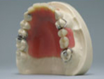 �ݸ�����ʬ�����