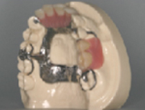 �������ʬ�����