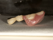 �����̥��������ͥ����פ���ʬ�����