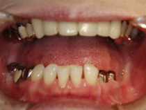 �����̥��������ͥ����פ���ʬ�����