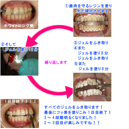 �ۥ磻�ȥ˥󥰥�������